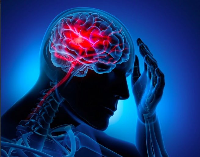 ¿Qué son y por qué se producen los ataques cerebrovasculares?