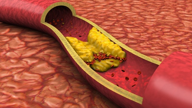 ¿Por qué se produce el colesterol en nuestro cuerpo?
