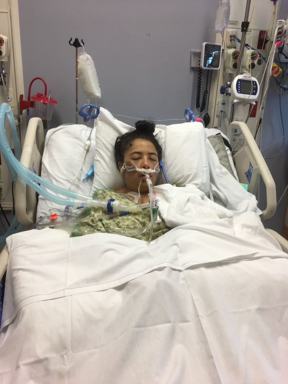 Buscan ayuda para mujer colombiana que tuvo accidente en Estados Unidos