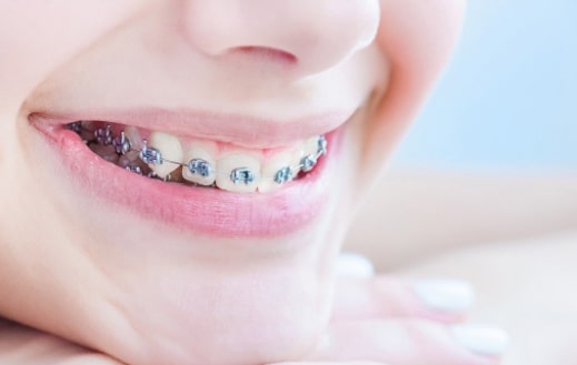Conozca todo lo que debe saber sobre la ortodoncia