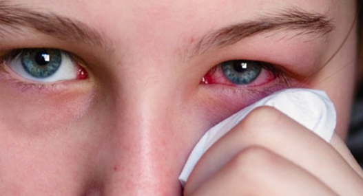 Por la letra enredada del médico, mujer se aplicó en un ojo crema para la disfunción eréctil