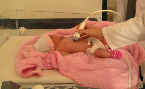 El asombroso caso de la bebé que 'nació embarazada' en Barranquilla