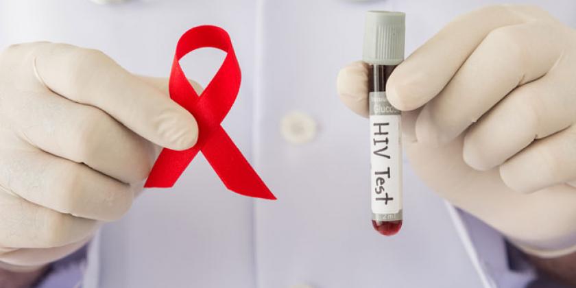 Se conmemora el día mundial contra el VIH Sida