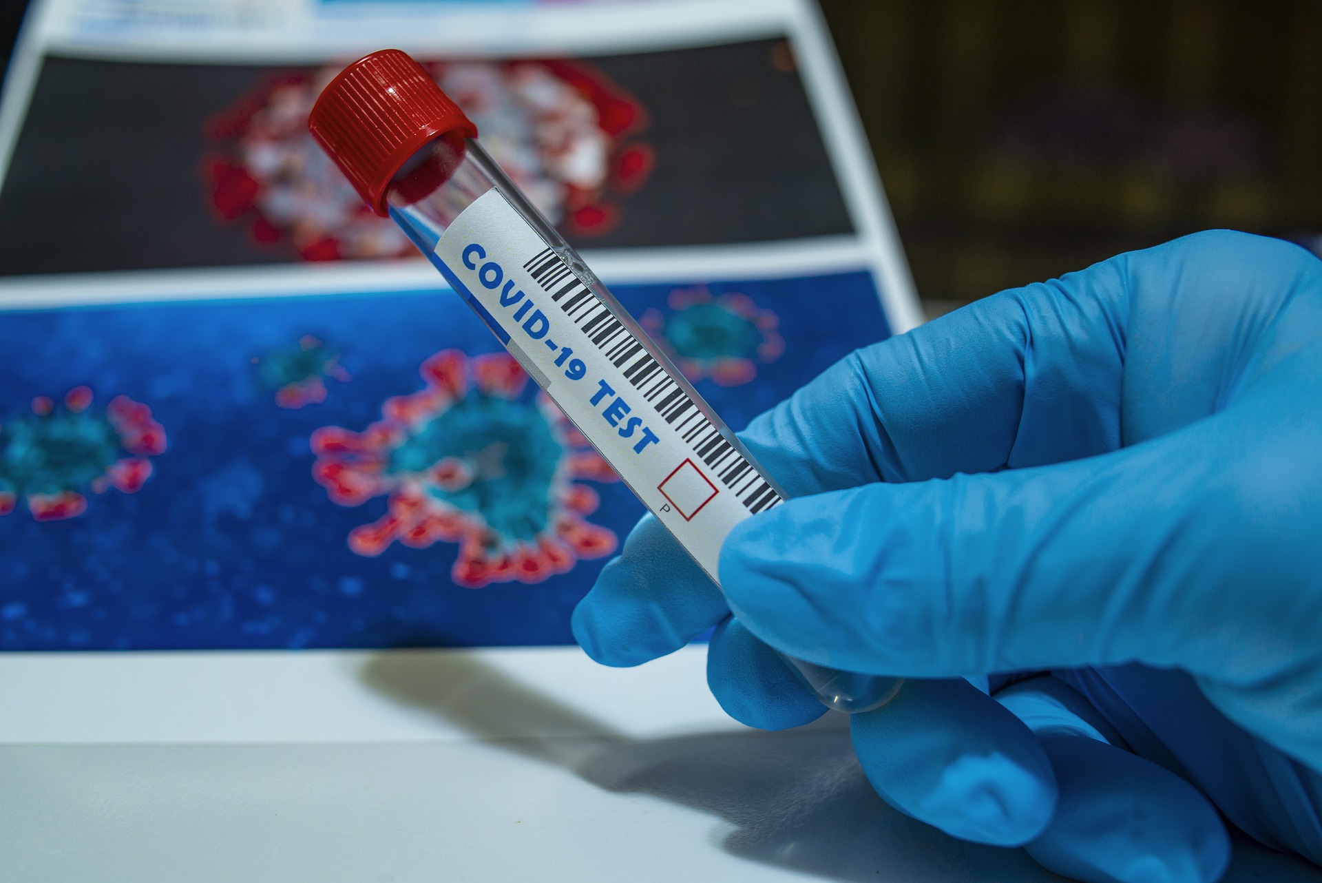 Fueron reportados nuevos casos de coronavirus en Envigado