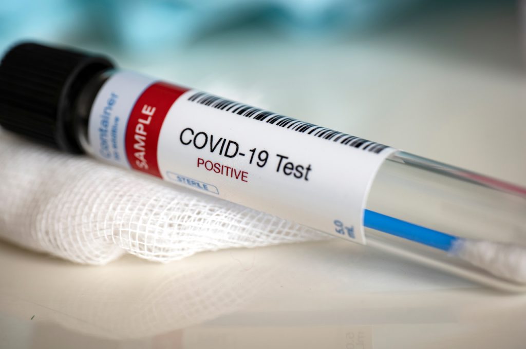 Coronavirus en Colombia: el país registró hoy 12.830 casos nuevos