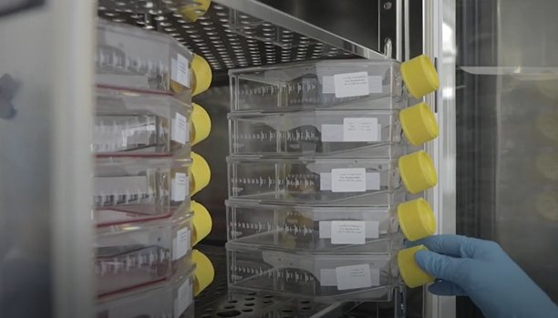 En Antioquia iniciará el ensayo clínico con células madre para pacientes covid