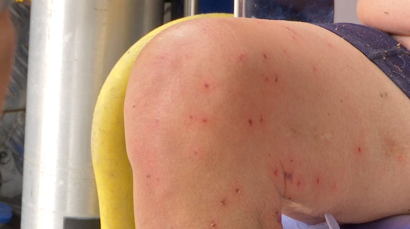 Un fallecido y 75 lesionados han dejado ataques de abejas este año en Medellín