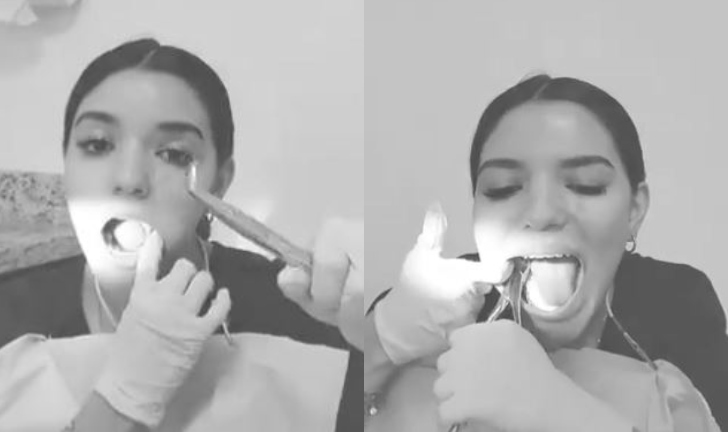(Video) Odontóloga se quita dos muelas y se vuelve viral en redes