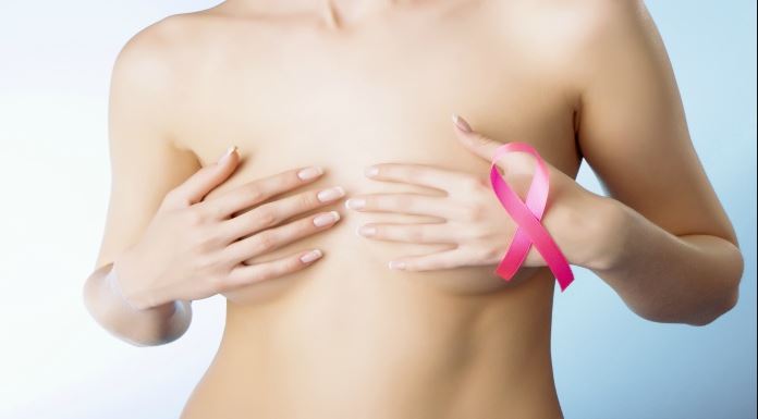 En 2020 hubo 15 mil diagnósticos y 4 mil muertes por cáncer de mama en Colombia