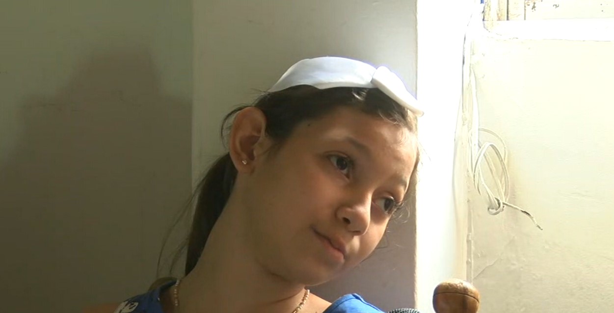 (Video) Niña con medio cerebro necesita ayudas para sobrevivir