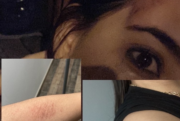 FOTOS: Presentadora de noticias fue brutalmente agredida por un taxista