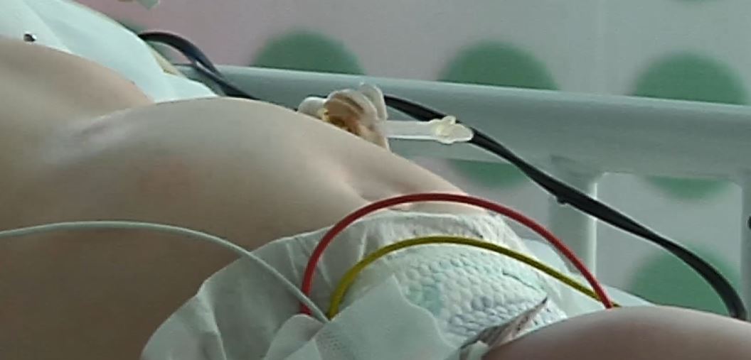 Tras 5 meses en UCI, bebé de 2 años requiere traslado urgente
