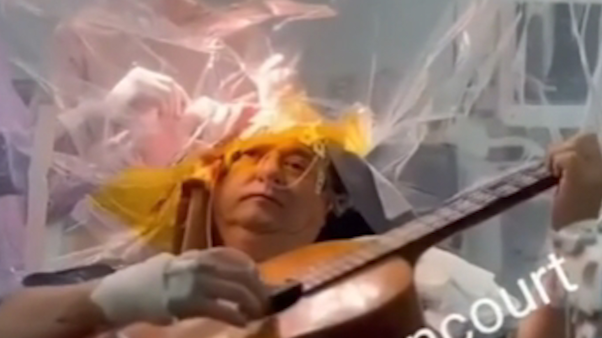[Video] Un hombre tocó la guitarra mientas le realizaban una cirugía cerebral