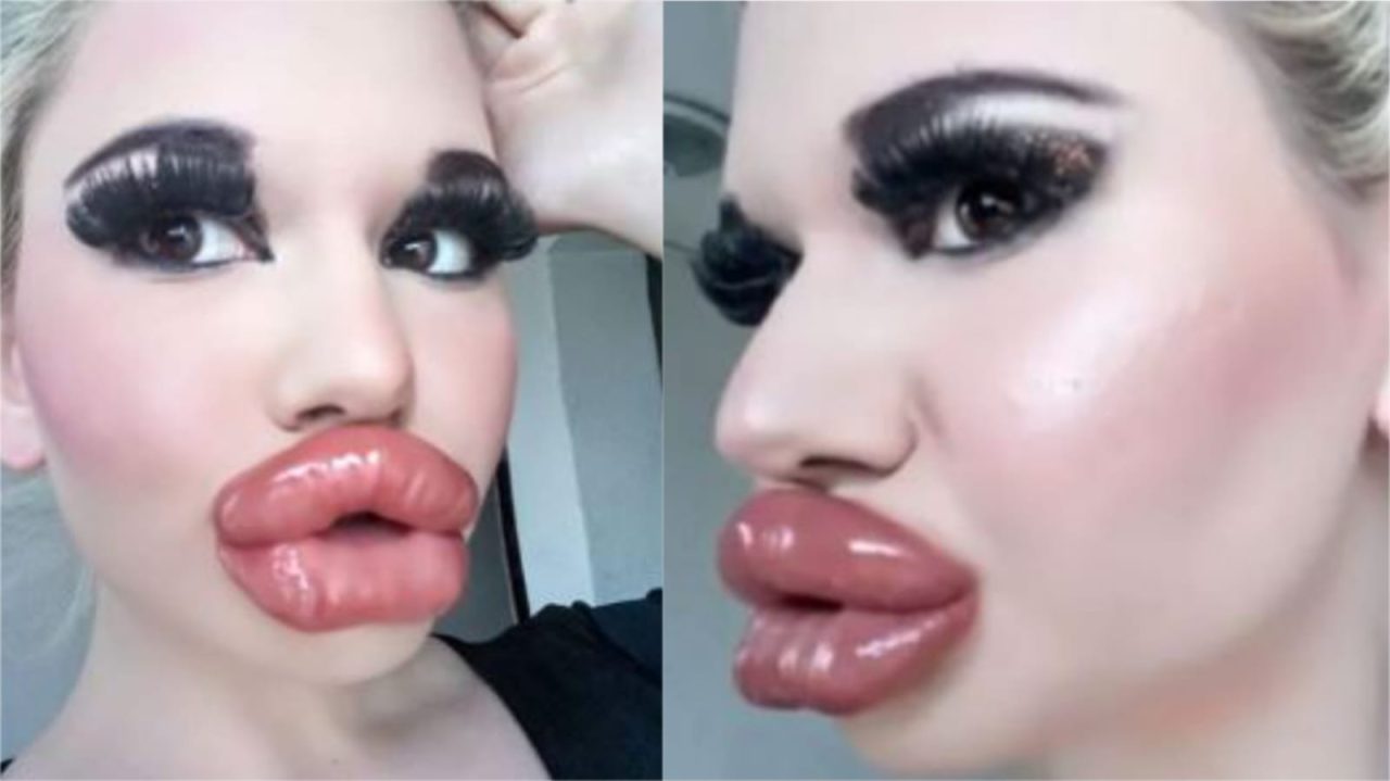 Tiene los labios más grandes del mundo y busca pareja que acepte su imagen