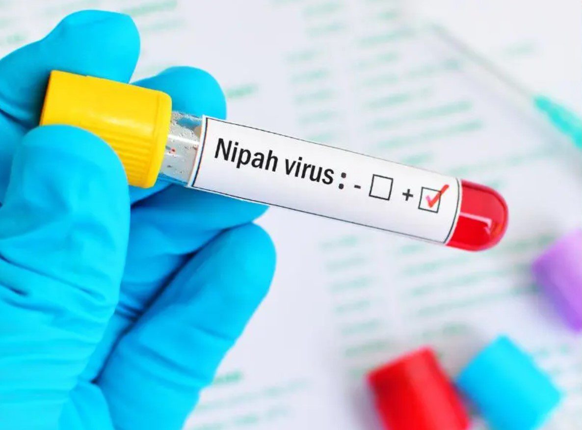 ¿Un nuevo virus? Nipah preocupa a los expertos