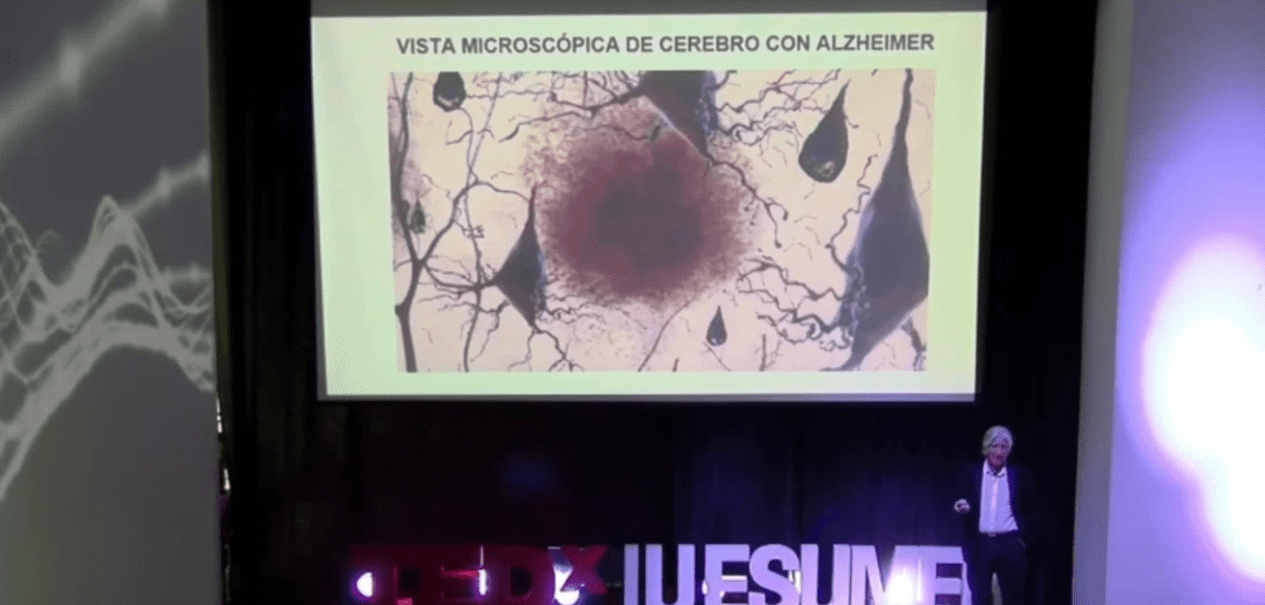 Grupo de la Universidad de Antioquia presenta avance para retrasar aparición del Alzheimer
