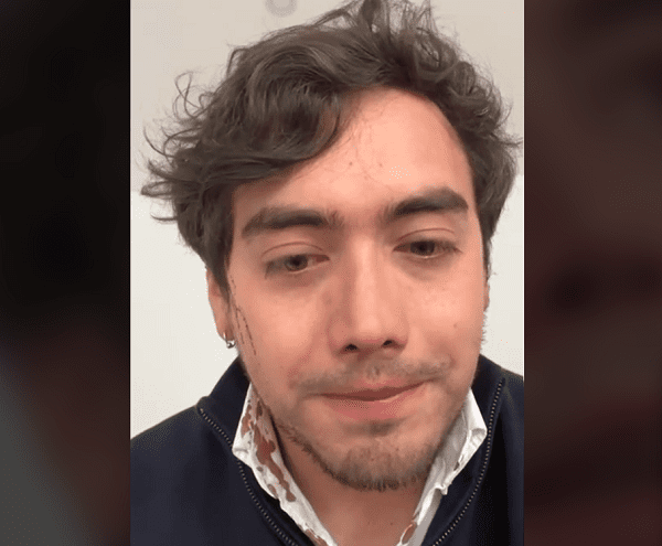 Concejal de Bogotá, Julián Triana, denuncia que fue víctima de violento robo