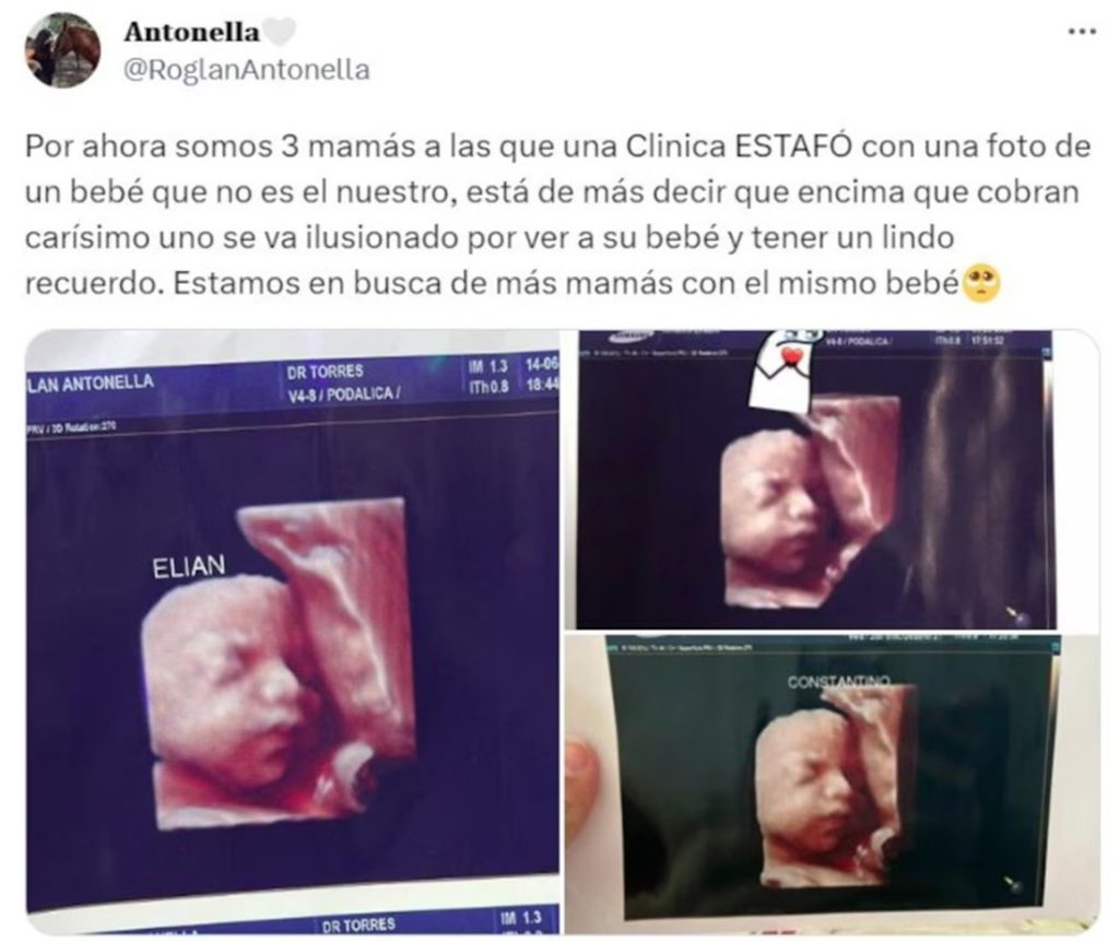 Una clínica usaba la misma ecografía falsa para todas las embarazadas. El caso estalló en redes y ya hay decenas de denuncias por fraude.