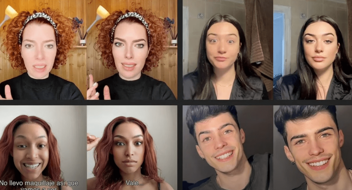 Filtros en redes sociales podrían influenciar a las personas a someterse a cirugías estéticas