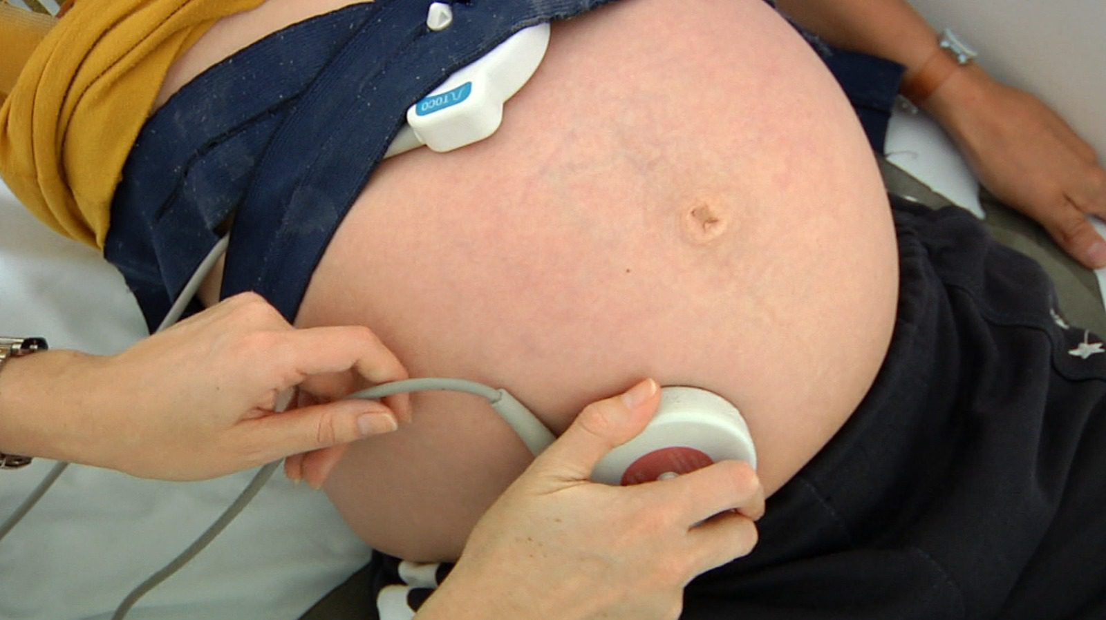 Cada vez hay menos camas para nacer en Medellín: déficit se estima en 65%