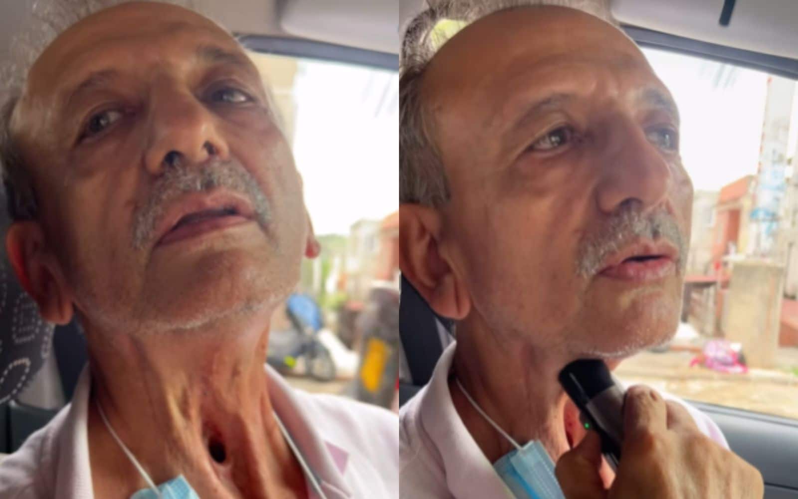 Hombre que perdió las cuerdas vocales envía mensaje a fumadores: “vea lo que me hice”