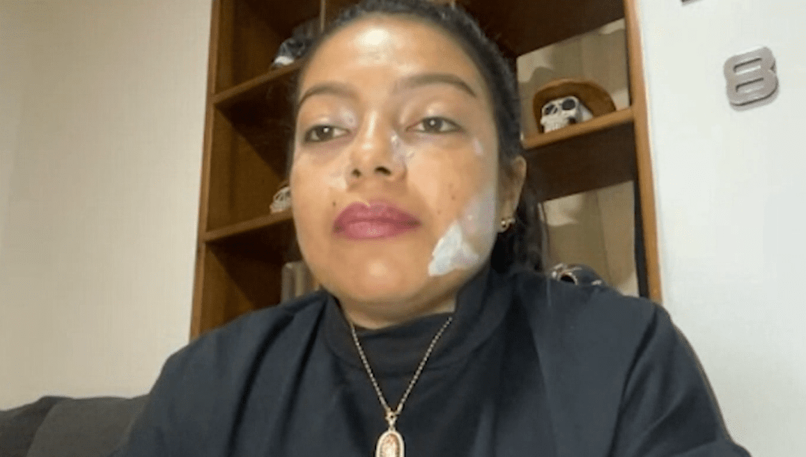 Habla enfermera que fue víctima de agresión en el hospital de Ciudad Bolívar