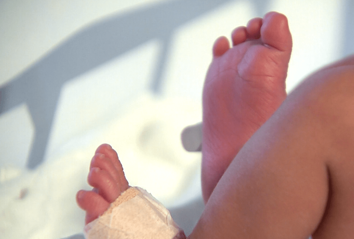 Dos niños fallecieron por desnutrición aguda en el Urabá antioqueño