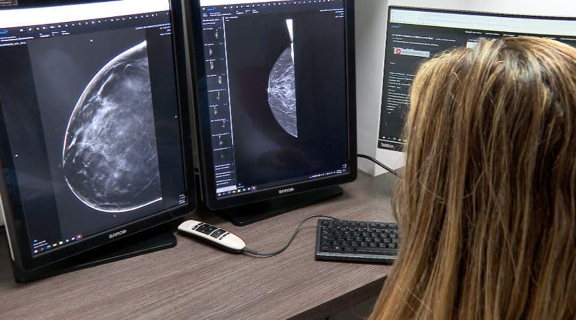 Más de dos millones de mujeres son diagnosticadas anualmente con cáncer de mama