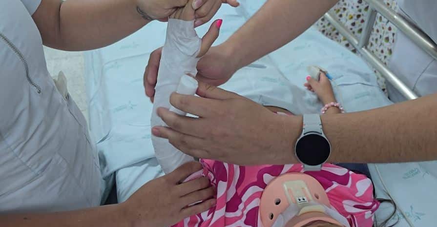 Hospital San Vicente alerta posible incremento de urgencias relacionadas con quemaduras