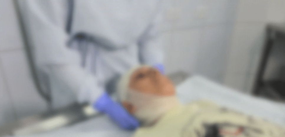 No ha comenzado diciembre y Antioquia ya lidera las cifras de quemados