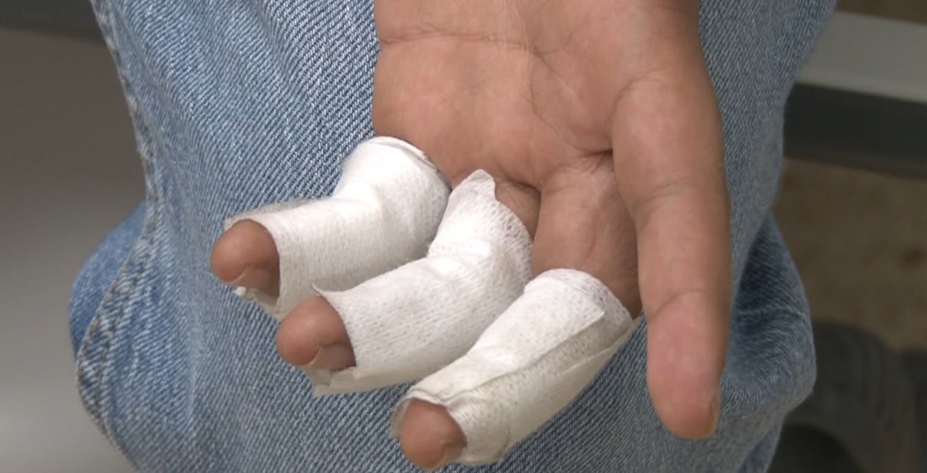 “Alborada” dejó once quemados con pólvora en Antioquia, tres son menores de edad