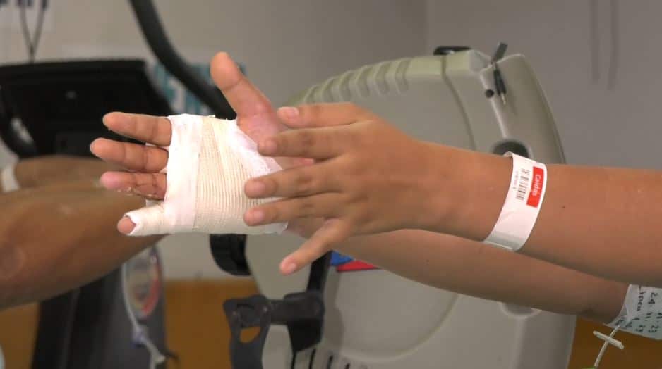 Cinco nuevos casos de quemados con pólvora; Antioquia ya suma 136 lesionados