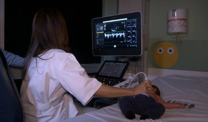 Hospital General recibió ecocardiógrafo pediátrico 