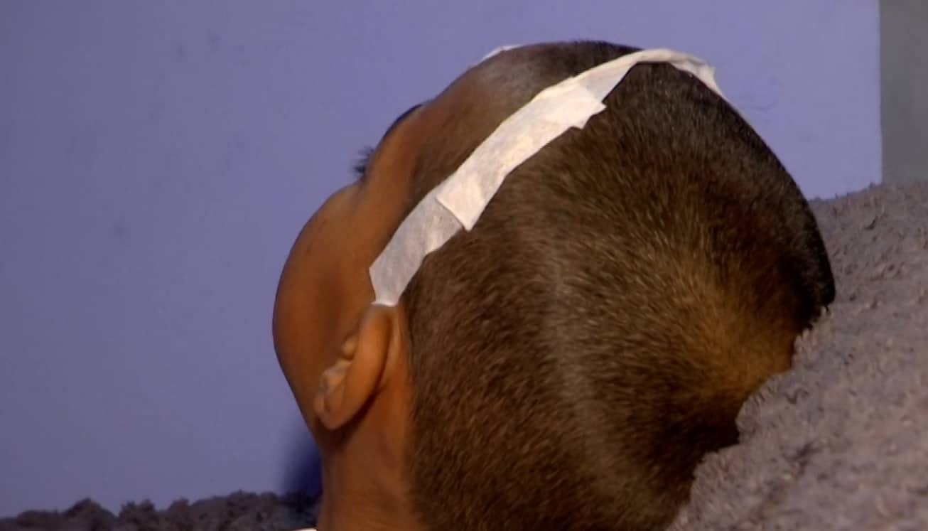 La historia del niño que estuvo en UCI después de ser atropellado por un bus en El Popular