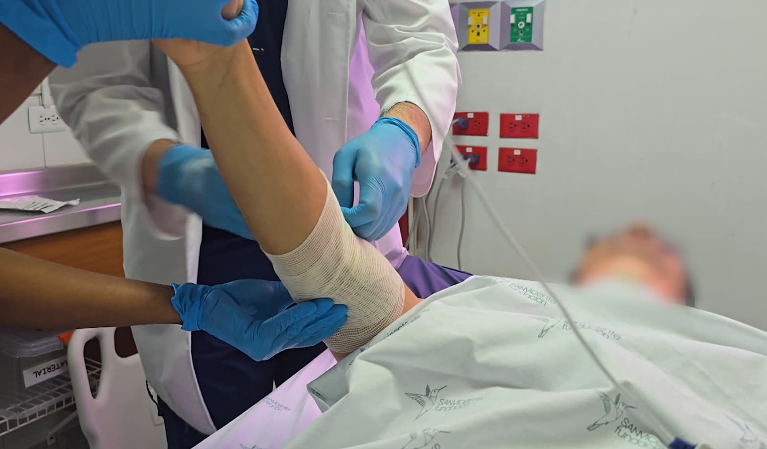 Más quemados con pólvora en Antioquia: ya van 33 casos