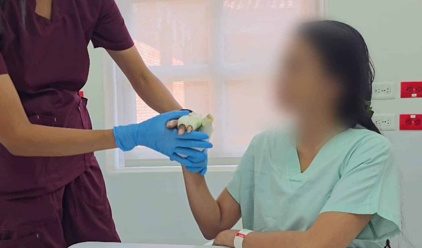 Antioquia llegó a los 200 quemados con pólvora 