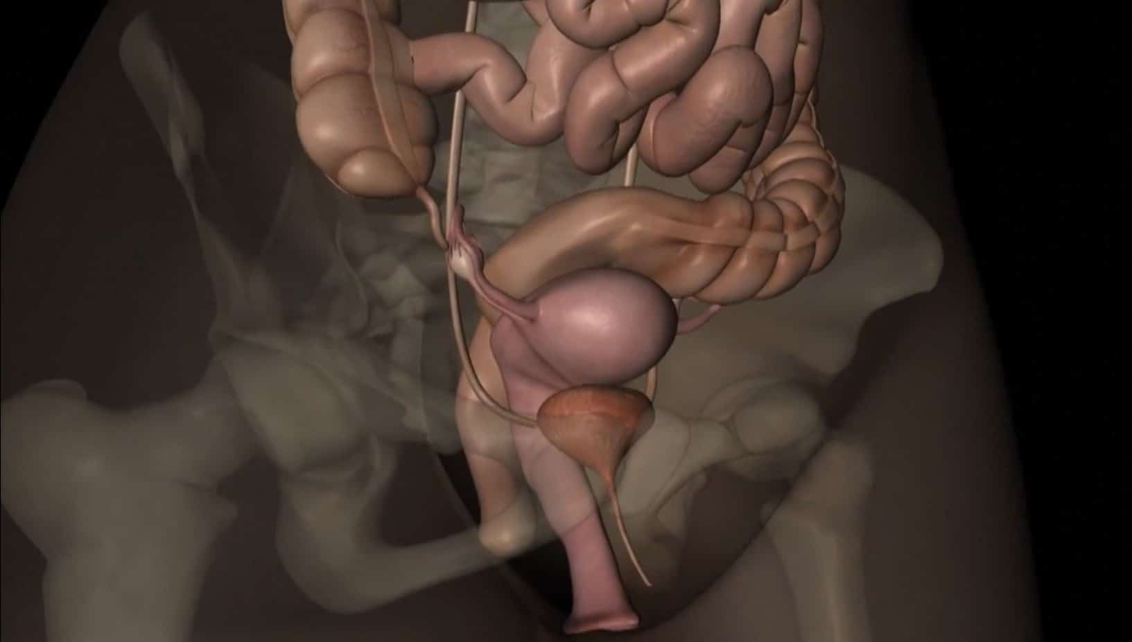 1 de cada 10 mujeres sufre endometriosis, estos son los síntomas