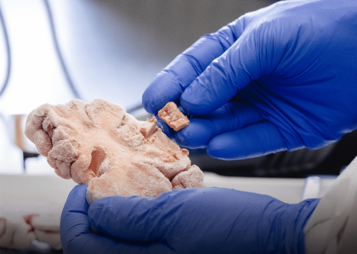 Investigación sobre alzhéimer en América Latina liderada por la Universidad de Antioquia