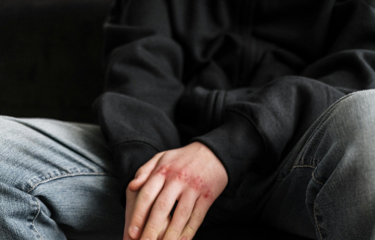 Adolescente resultó herido en riña con arma blanca a las afueras de colegio en Villa Hermosa