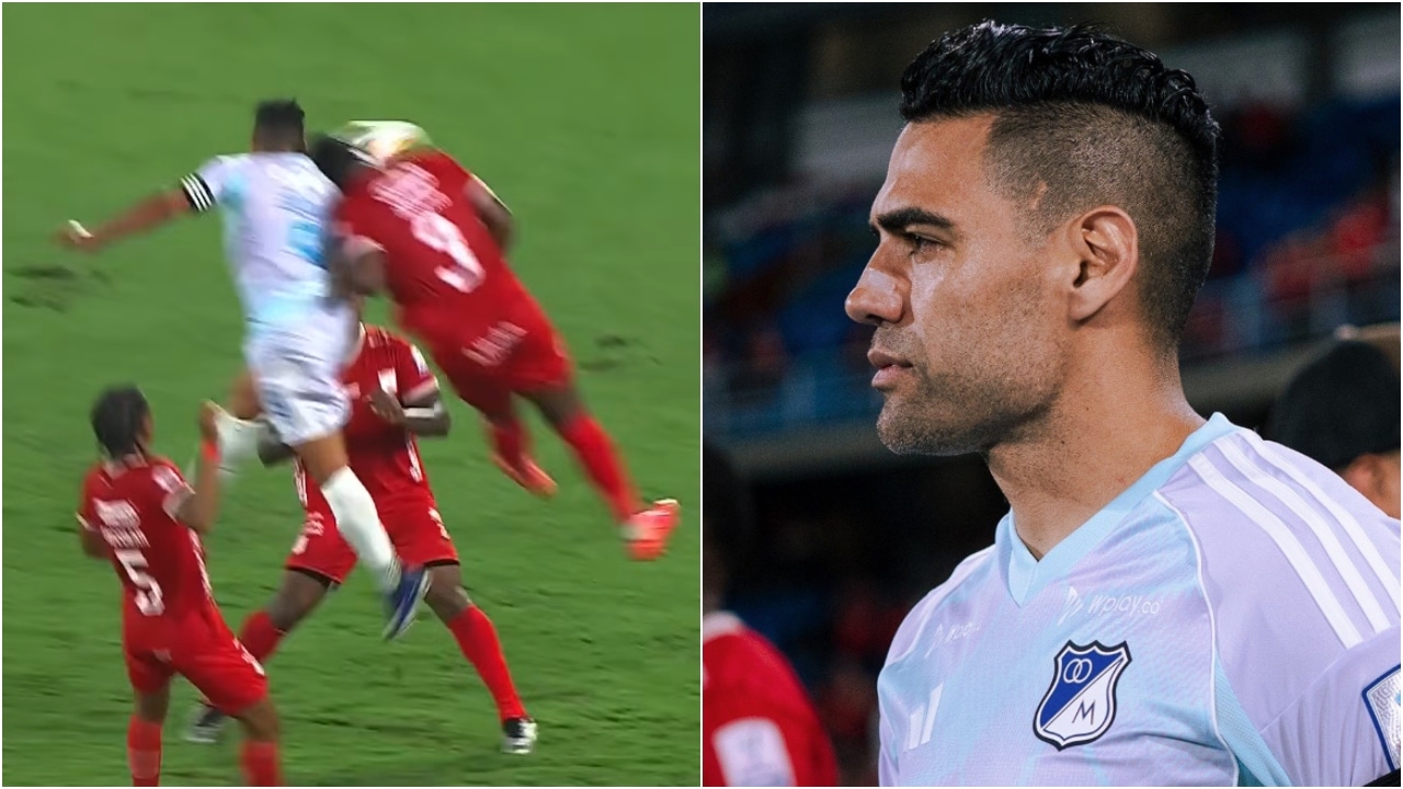 Este es el parte médico de Falcao tras el violento golpe que sufrió en partido ante América