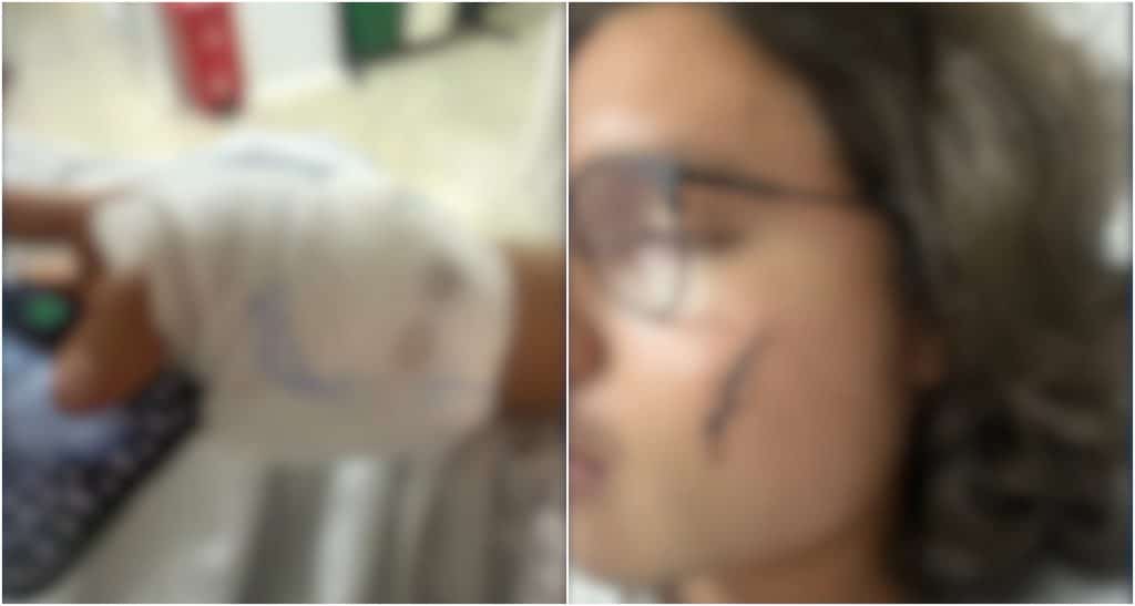 Joven fue brutalmente agredido por no querer pagar un supuesto daño de un control de televisión