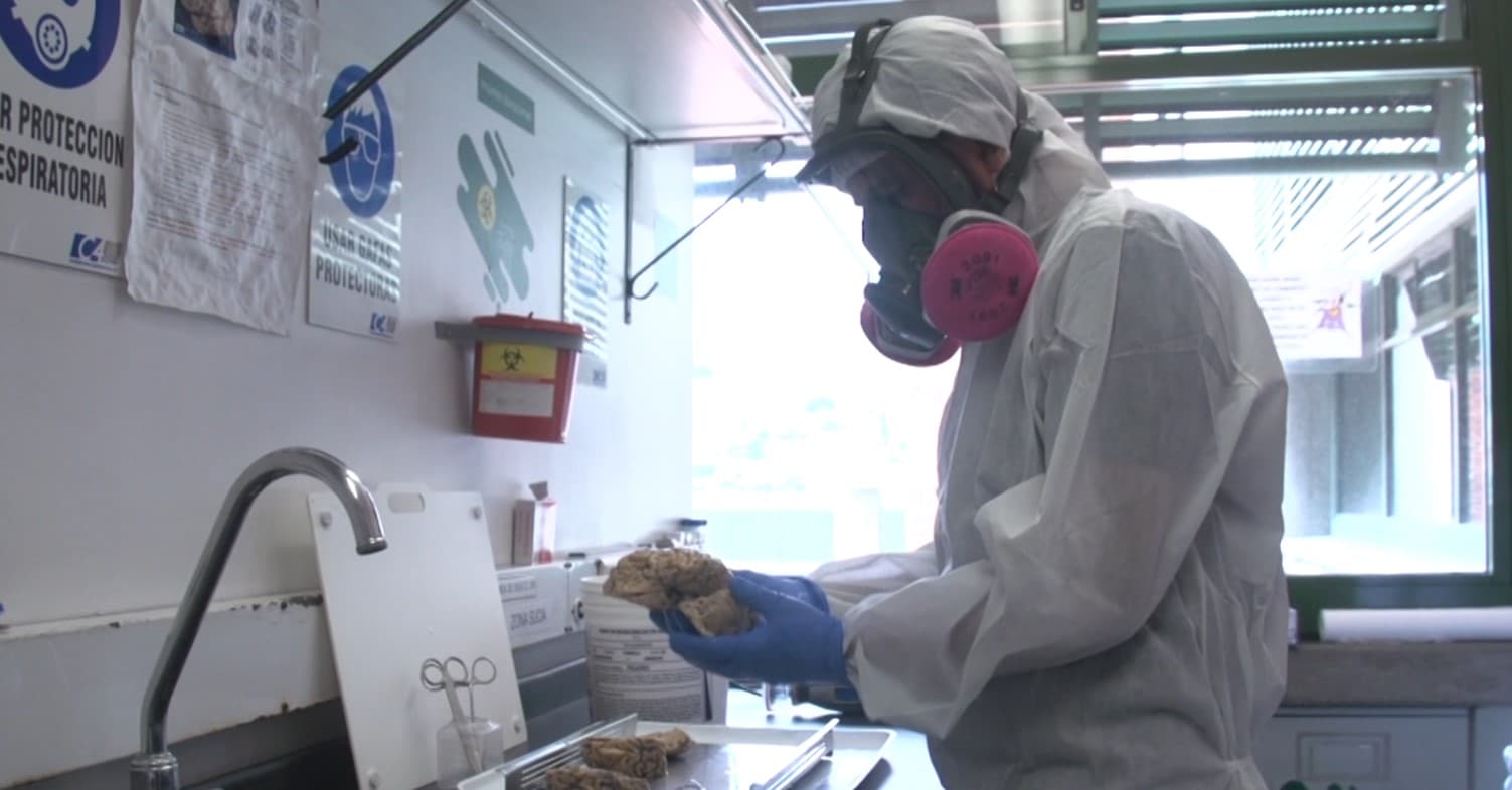 Medellín alberga el segundo banco de cerebros más grande de Latinoamérica