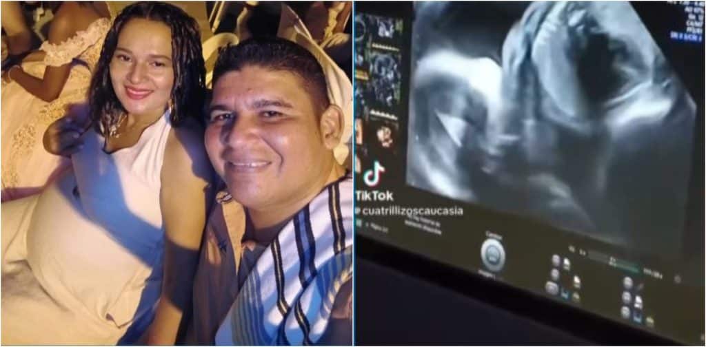 Extraordinario caso de cuatrillizos idénticos en Medellín